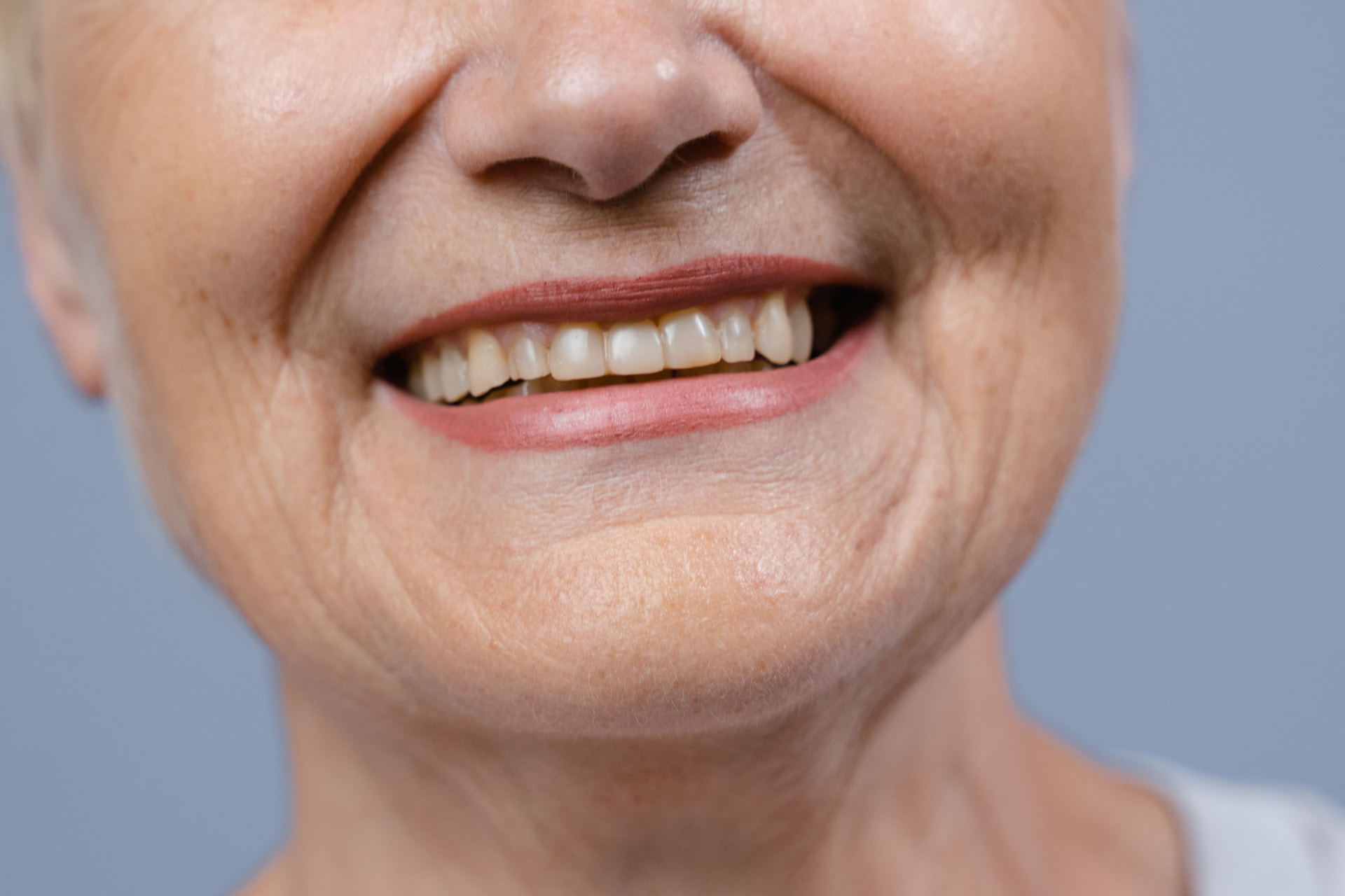 Close-up of an older patient smiling after restorative dental treatment